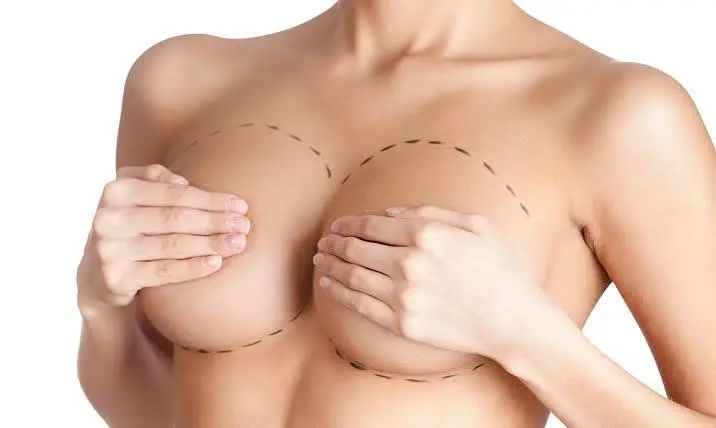 Breast Aesthetics